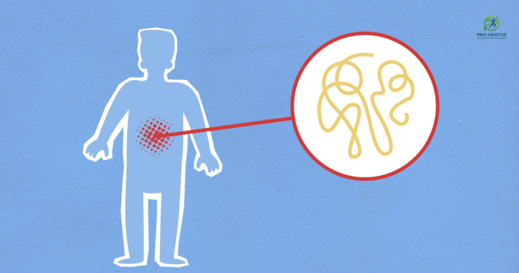 An infographic showing a human silhouette with red inflammation in the gut area, linked to a circular call-out showing tangled yellow fibers representing the intestinal environment.
